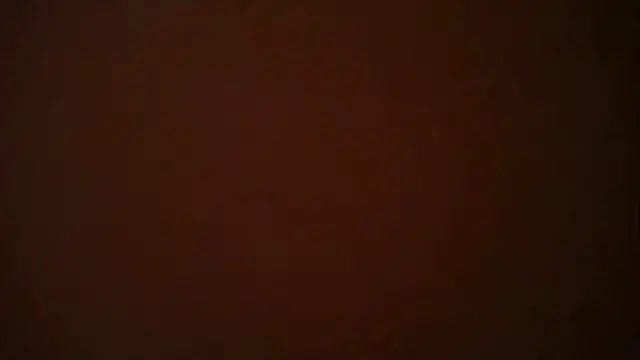 Snapshot of Leanymphoo chatting on March 2025 09:48:02 PM Leanymphoo online show from March 2025 09:48:02 PM