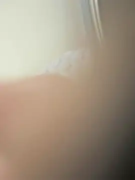 Snapshot of furkanktyAcalea chatting on November 2025 10:25:02 PM furkanktyAcalea online show from November 2025 10:25:02 PM